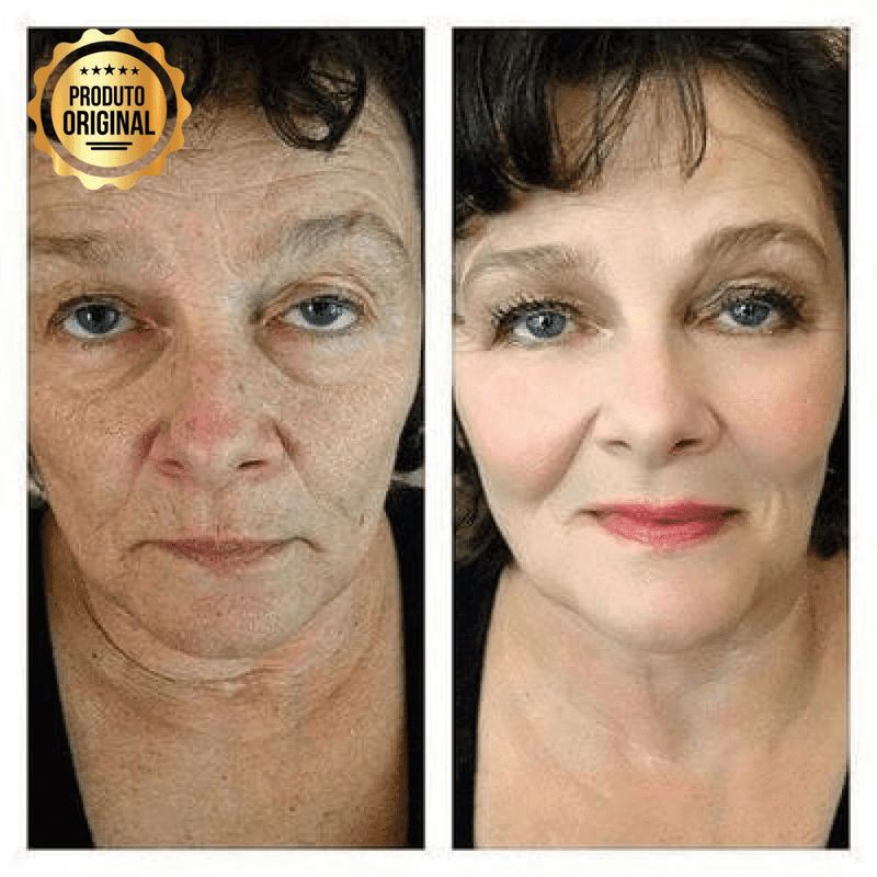 Base BB Cream Original® com Proteção FPS 40 e Ácido Hialurônico + 3 Brindes