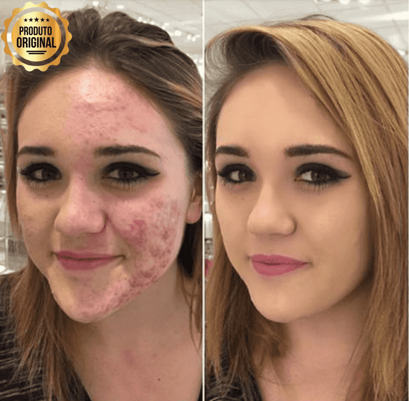 Base BB Cream Original® com Proteção FPS 40 e Ácido Hialurônico + 3 Brindes