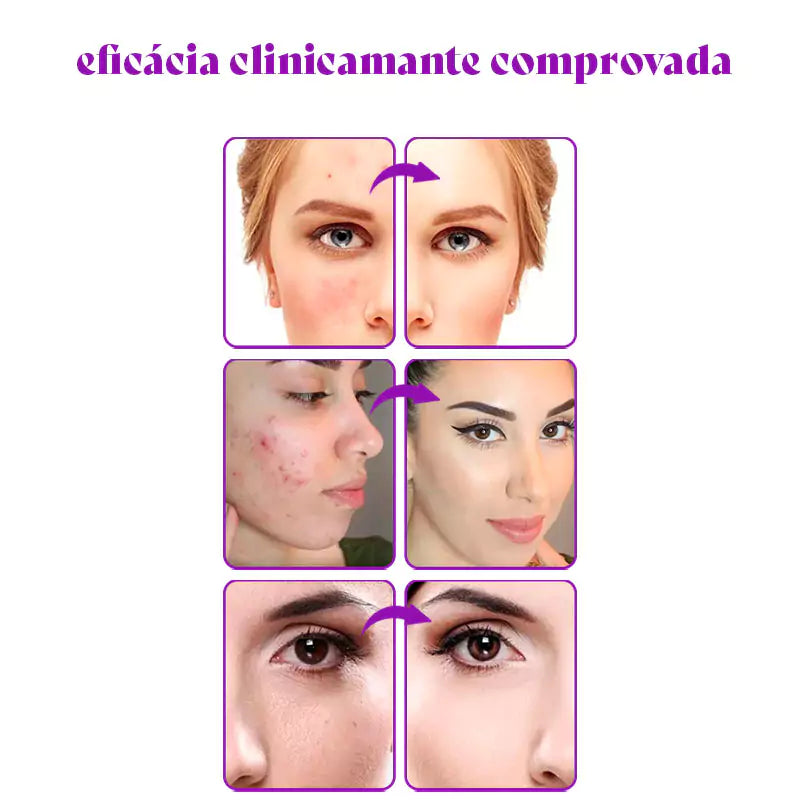 Base Color Match® 4 em 1 Inteligente Que se Adapta a Qualquer Tom de Pele